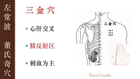 三金穴|三金穴是指什么